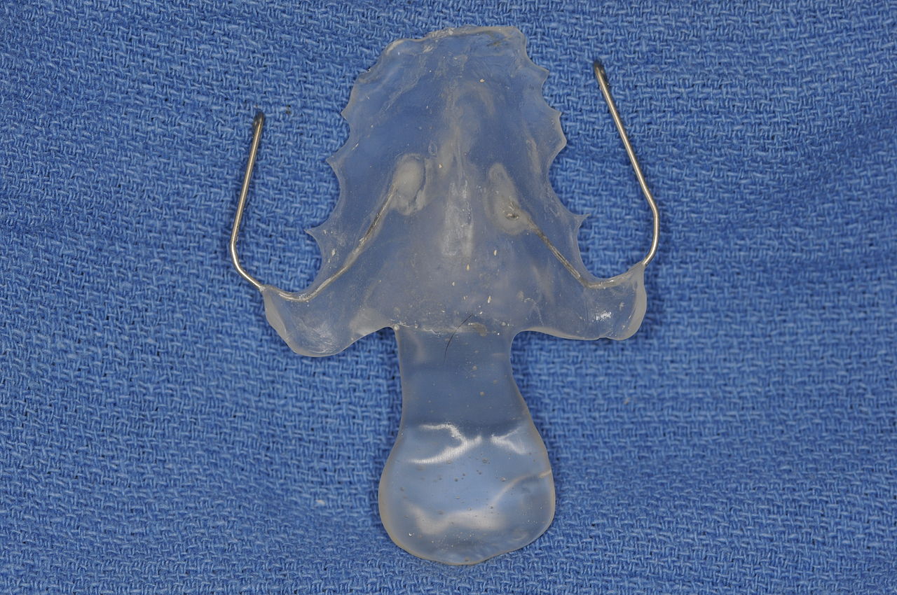 Palatal Lift Prosthesis Aragon Prosthodontics